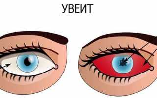 Что делать, если начинает дёргаться глаз – лечение и профилактика