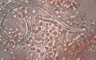 Стронгилоидоз или кишечные угрицы: как не заразиться
