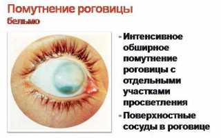 Причины помутнения роговицы глаза и способы лечения