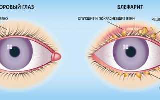 Строение, анатомия и болезни нижнего и верхнего век глаз