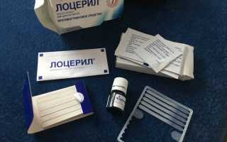 Описание и инструкция по применению противогрибкового препарата Лоцерил